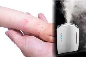 Best Humidifier for Eczema