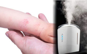 Humidifier for Eczema featured image